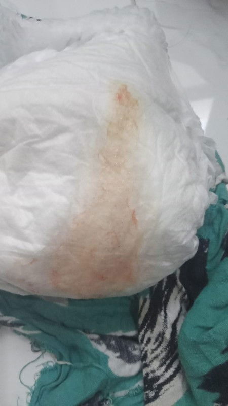 Bunda ada yg pengalaman anaknya kyk gini GK?