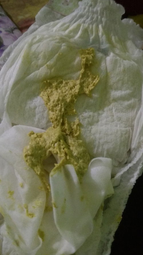 Warna pup bayi 2 bulan 16 hari