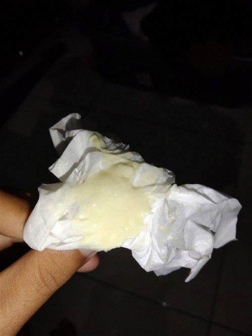 Tm3 keluar keputihan banyak