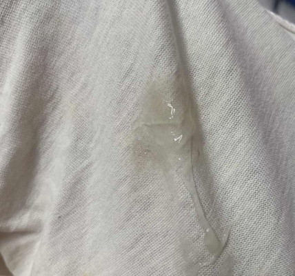 mtk maaf gmbr menggelikan sikit. nk tya pndapat, kalau kuar lendir cmni keputihan biasa ke ape?😖