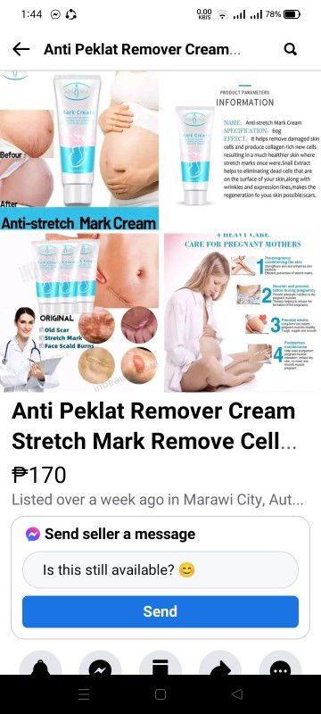 Effective poba to? Ilang months kaya bago mawala pag gumamit nito?😊