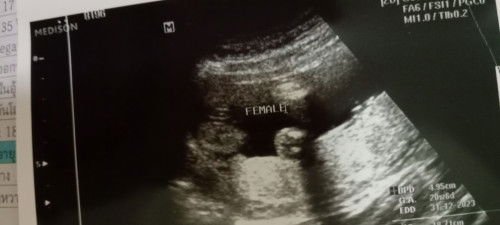 การตั้งครรภ์