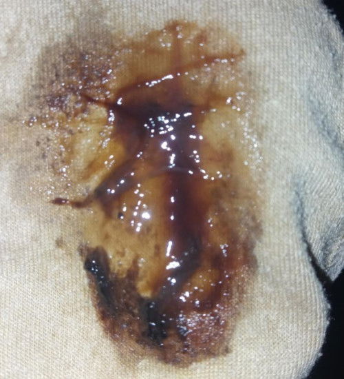 Apakah tanda mau melahirkan?