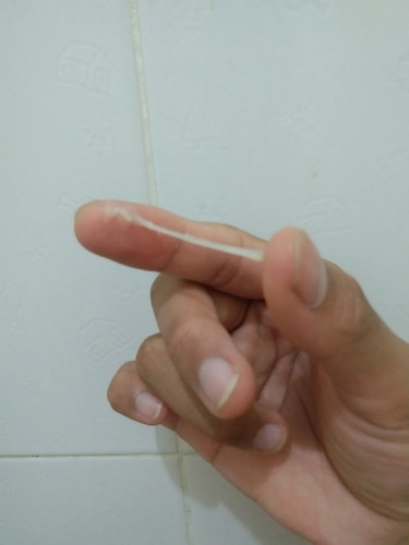 ตั้งครรภ์