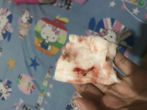 Assalammuallaikum bunda saya ingin beranya apakah ini darah implantasi atau darah haid ya ? 🙏🏻