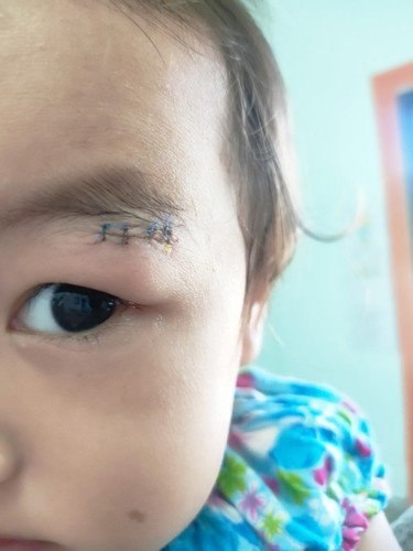 ลูกสาวลื่นล้มในห้องน้ำค่ะ