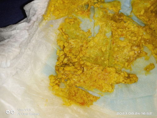 Kalau baby 6 bulan berak macam ni normal ke....