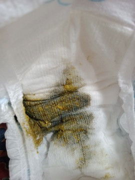 Normal lg po ba yung poop na dark green?