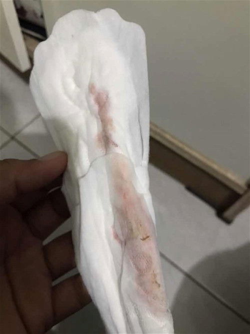 Keluar darah kehamilan 11 week