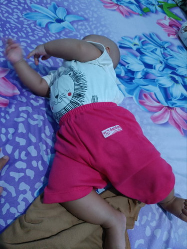 Bayi miring sambil merengek