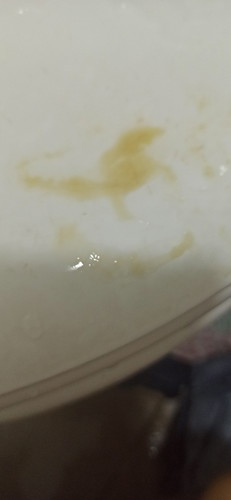Salam Nak Tanya Sape Pernah Kluar Cecair Mcm Ni Wrna Coklat Cair Smpai Basah Spender,