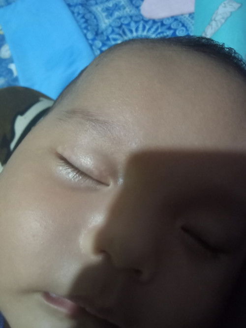 Di kelopak mata ada warna putih