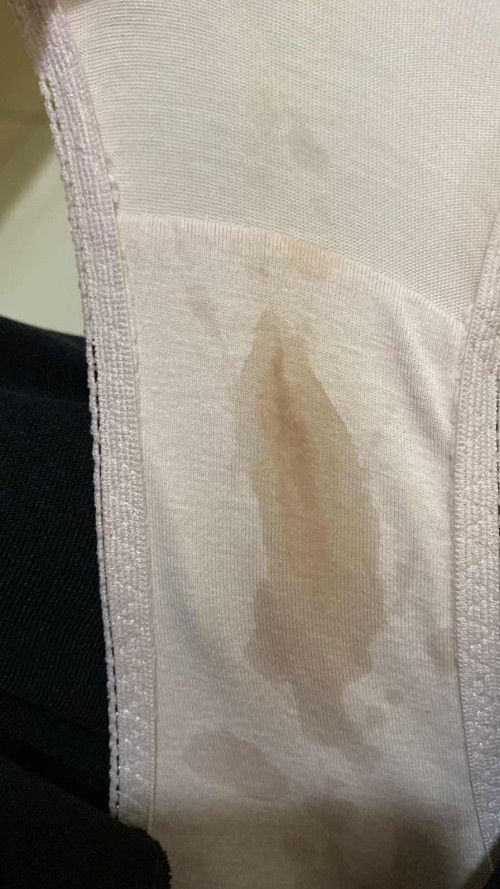 Apakah flek coklat seperti ini aman?