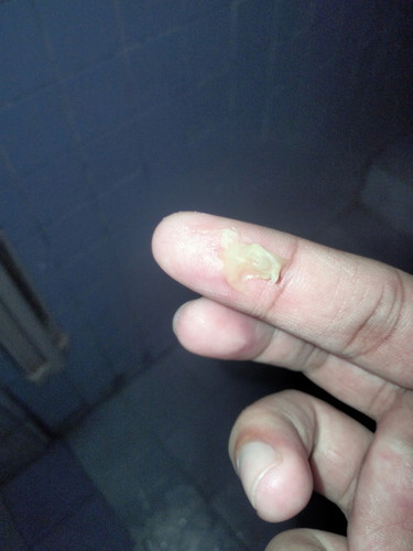 อันนี้ออกจากช่องคลอดมันคืออะไรหรอคะ