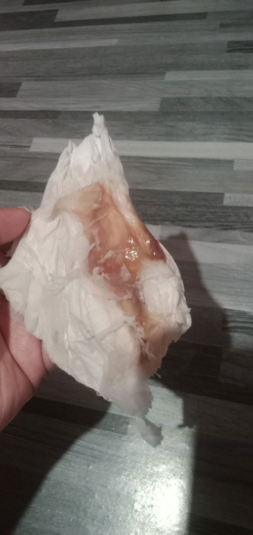 มีมูกเลือดสีน้ำตาลออกหลังคลอดได้2เดือน13วัน อันตรายไหม