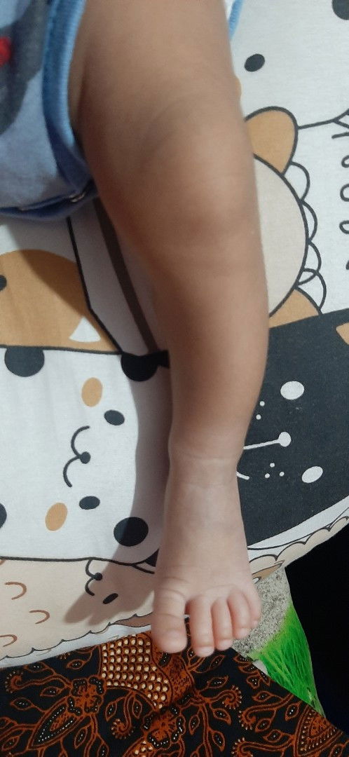 Apakah kaki anakku normal bun?