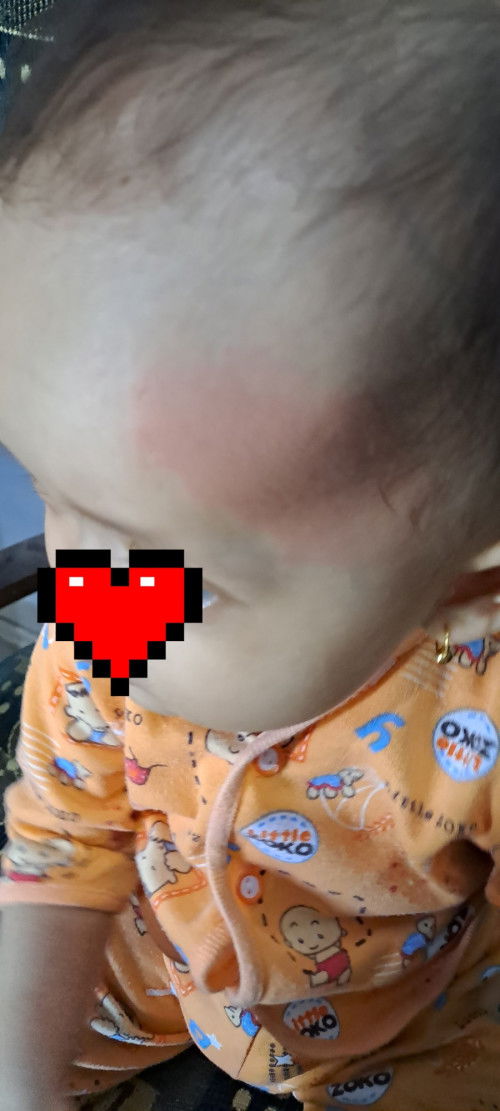 Cap merah di dahi bayi