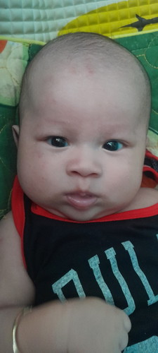 Các mom cho em hỏi ạ bé nhà em được 2m22d rồi mà bị nổi mục đỏ đỏ ngay mặt với tay ạ là bị sao vậy ạ