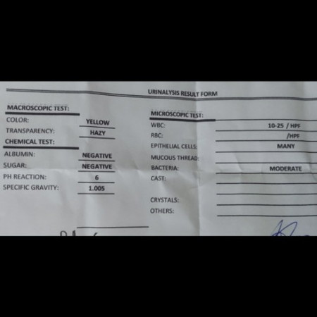 may UTI po ba ko?