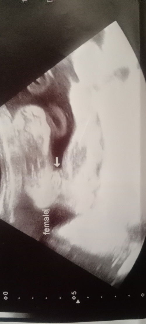 32+3บ้านไหนดิ้นเเรงบ้าง