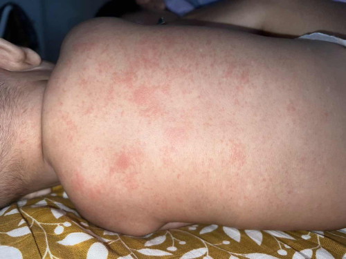 MINTAK TLG TGKK KANN !!