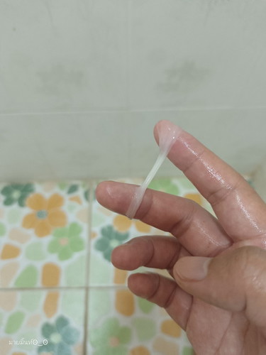 มีมูกเเบบนี้อีกกี่วันจะคลอดค่ะ
