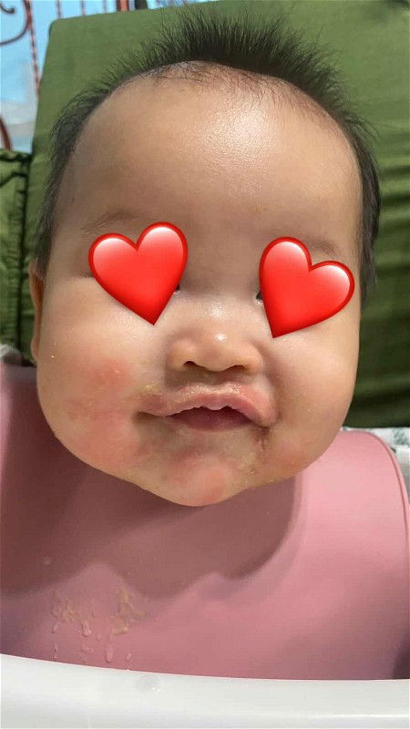 MPASI ikan kembung bikin kulit merah