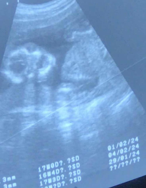 สวัสดีครับพี่ๆ ผมชื่อฮันเตอร์ครับ 🤍