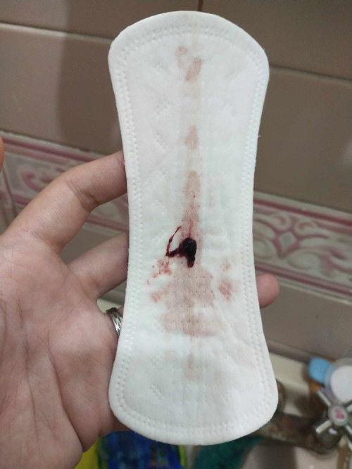 mild bleeding 26weeks, what to do?