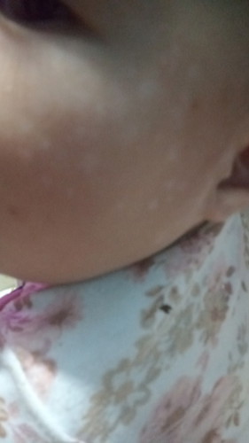 hello po mga mommy, ano po kaya pwedeng igamot kay baby, mag 1 yr old po sya next month.