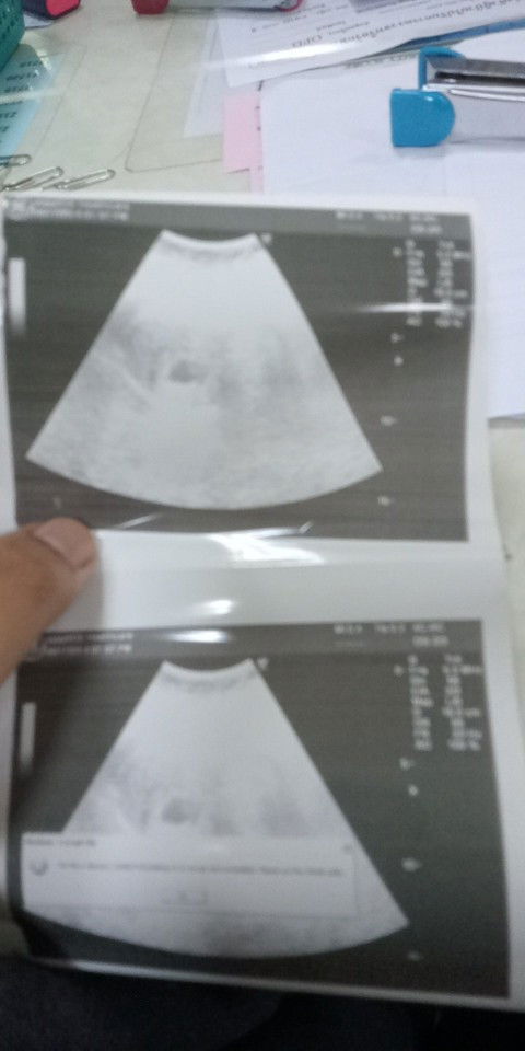 ขอสอบถามหน่อยน่ะค่ะ