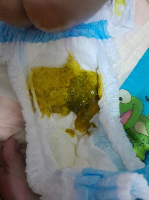 ลูกอึออกมาเป็นสีเขียวเข้มออกดำๆ