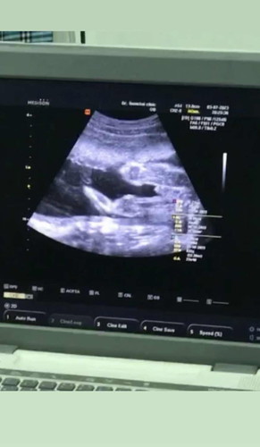 ท้องแรกค่ะ แม่ๆช่วยคอมเฟิร์มหน่อย