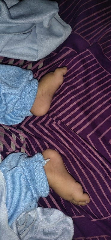 Tentang perkembangan bayii prematur