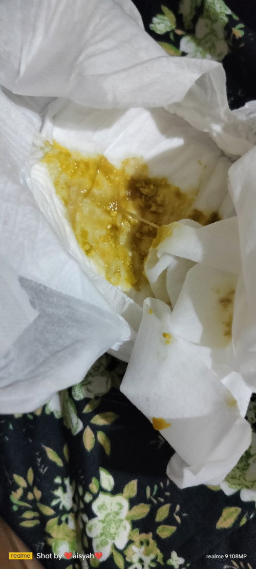 Hye normal ka bayi 4bln lbih kerap berak 4x shri?njis kdg pkt mustard+bji2 cair..bayi bf+fm Ammumlac