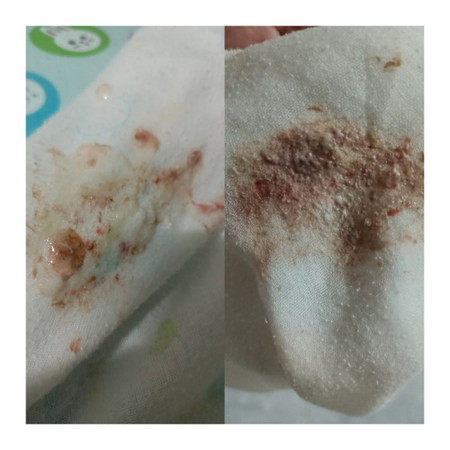 ลูกแหวะนมเป็นสีน้ำตาล