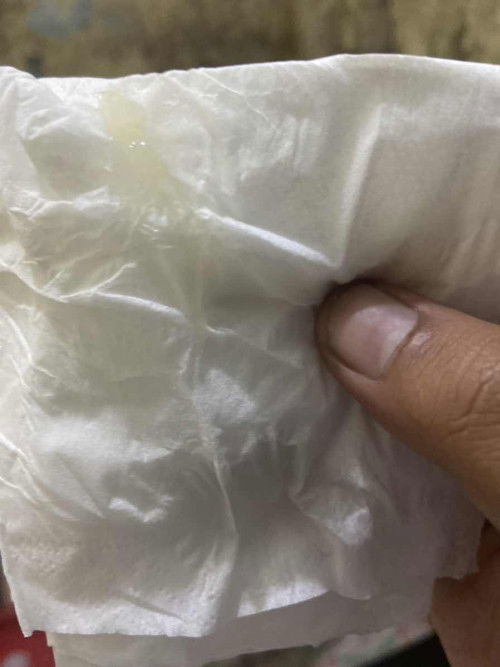 ขอสอบถามหน่อยคะอันนี้คือมูกหรือเปบ่า