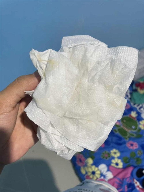 มีมูกไหลออกตอนเช้าตื่นนอน 39W+5