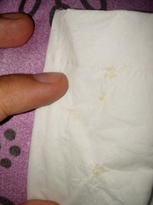 Asi bukan sih Bun ini ? Uk 37w2d