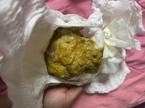 สอบถามแม่ๆค่ะ