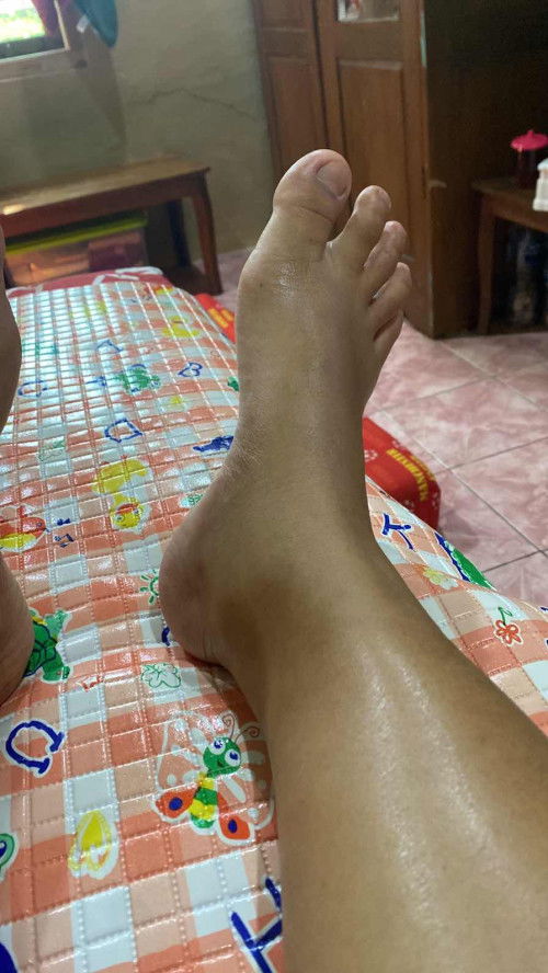 Bun serius mau nanyaaa