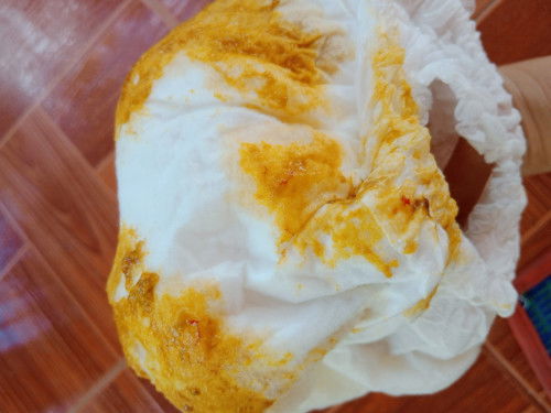 น้อง4เดือนอึเป็นมูกเลือด