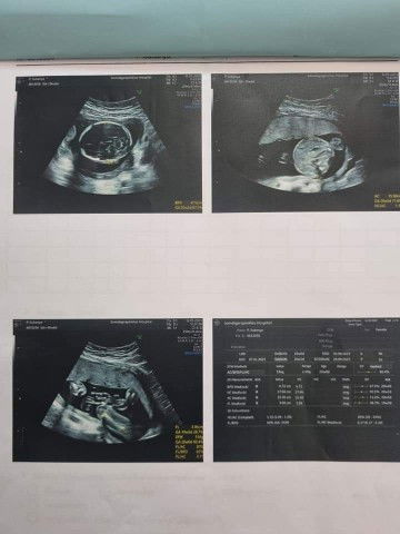 ผู้หญิง&ผู้ชาย