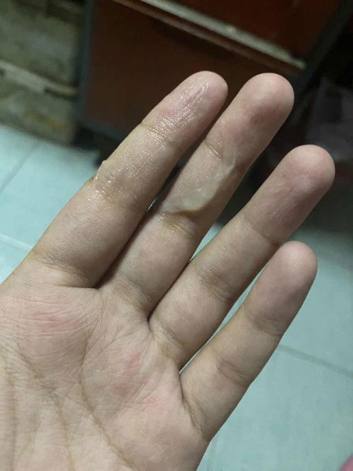 มูกหรืออะไรหนอค่ะ