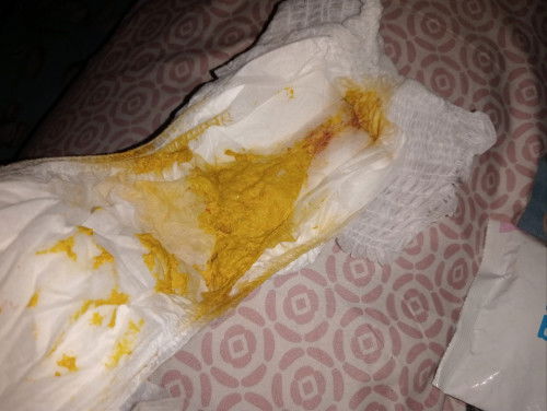 BAB bayi berlendir dan ada warna merah