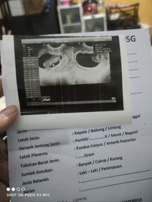 bayi tidak berkembang