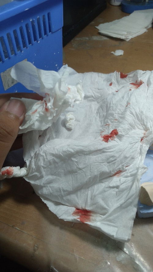 Normal kah, atau ada yg sama?