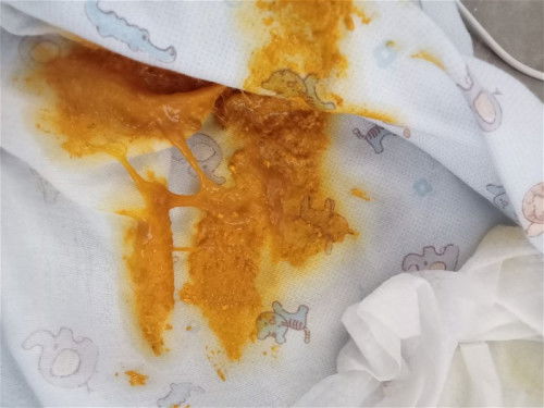 ลูกถ่ายเป็นมูกแบบนี้อันตรายมั้ยคะ