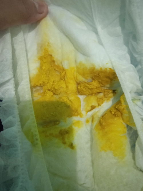 Pub bayi asi dan sufor