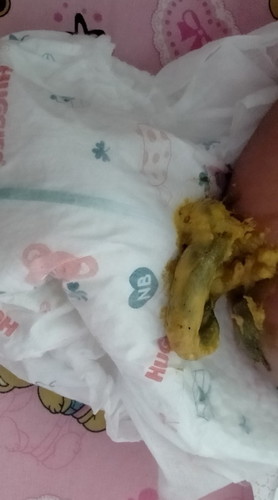 Kenapa najis bayi kuning hijau?